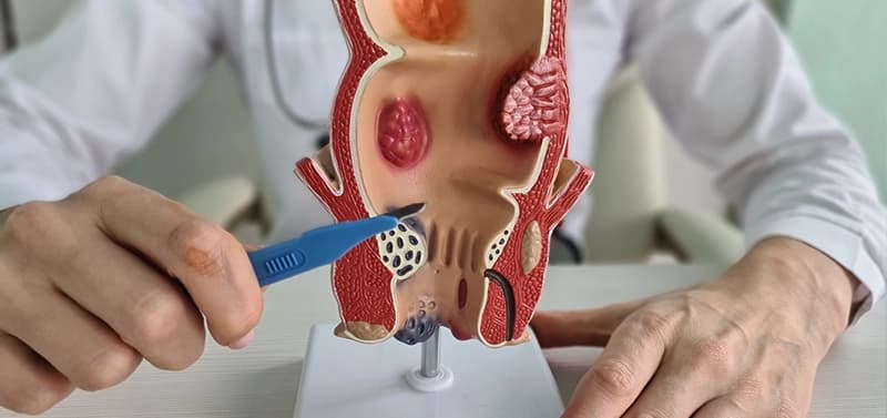 Laser Surgery by Experienced Surgeons